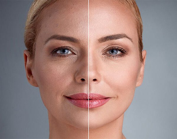 بهترین و سریعترین روش برای جوانسازی و سفتی پوست صورت
