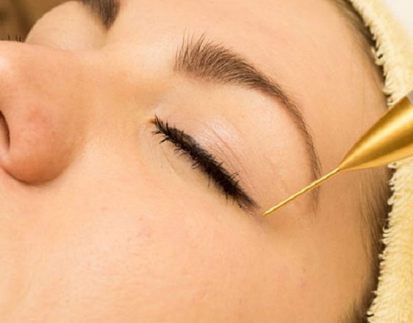 همایش JETT PLASMA LIFT