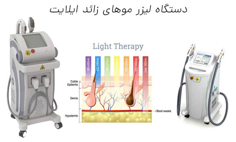 بررسی دستگاه لیزر مو زائد ایلایت (E-light)