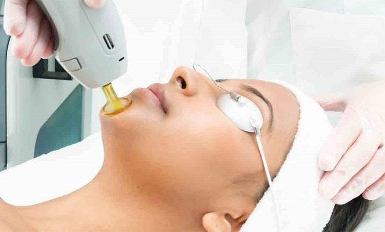 مزایا و عوارض دستگاه لیزر فوتونا چیست؟