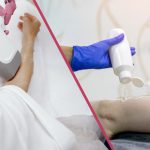 تفاوت لیزر با ژل و بدون ژل
