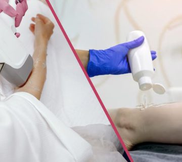 تفاوت لیزر با ژل و بدون ژل